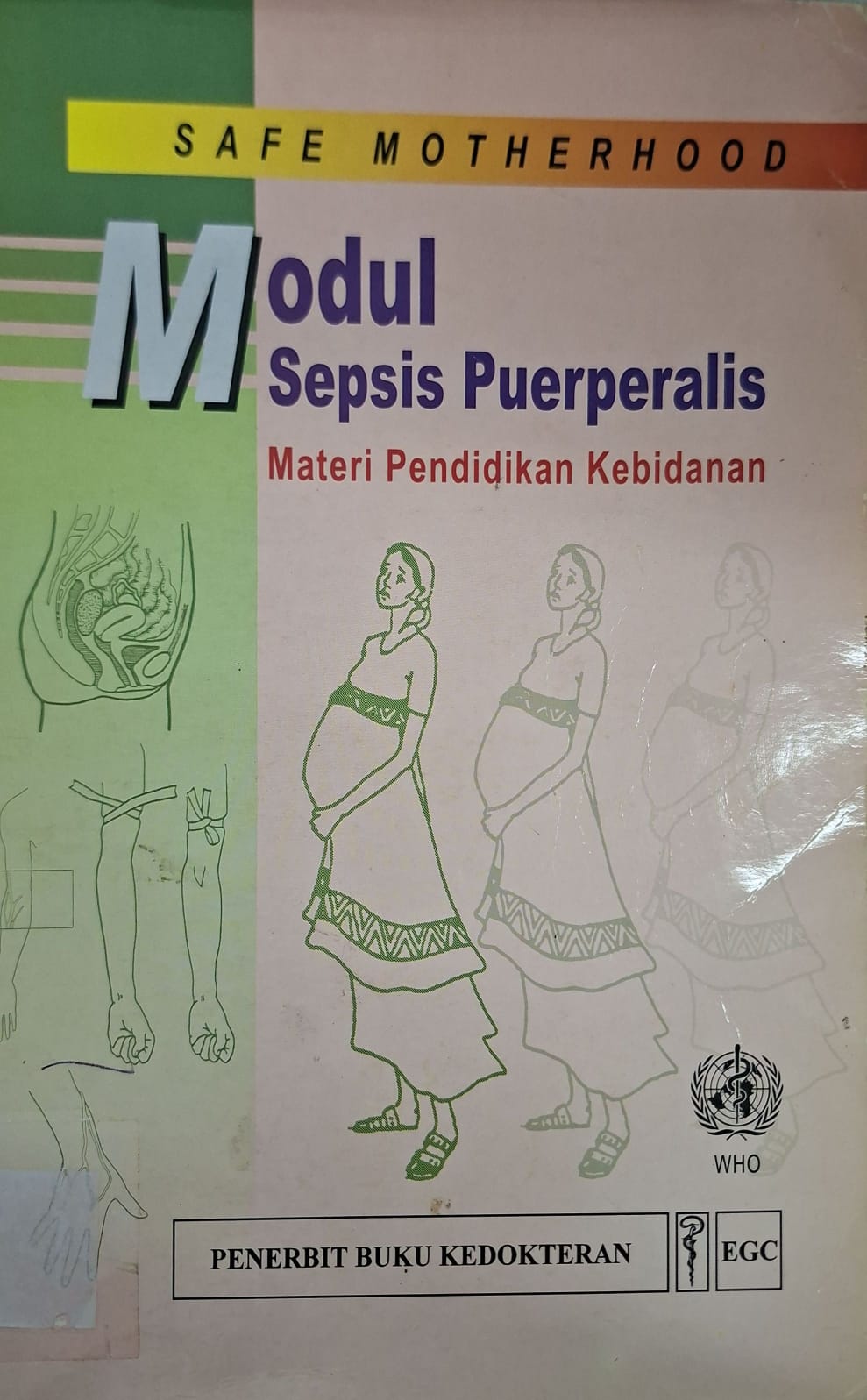 Safe motherhood Modul sepsis puerperalis: materi pendidikan kebidanan