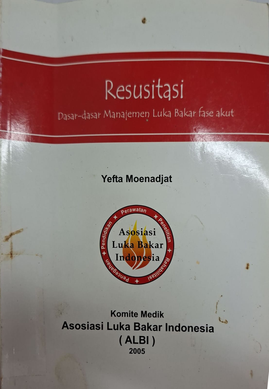 Resusitasi dasar-dasar manajemen luka bakar fase akut